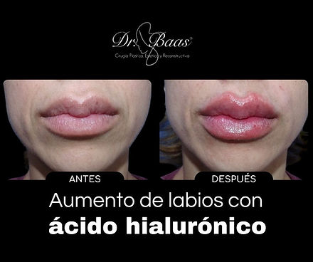 Publicidad (65).jpg