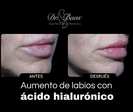 Publicidad (74).jpg