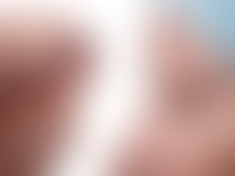 Recuperación de Blefaroplastia: Lo que nadie te dice de los primeros 7 días.