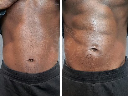T shock before and after ABS