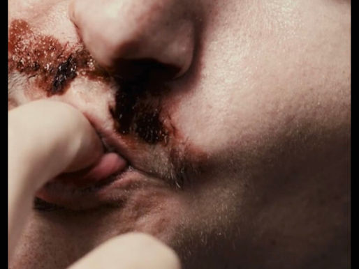 Nosebleed