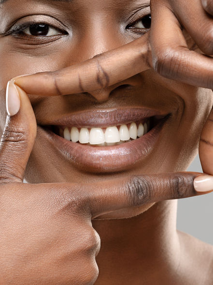 Smile Check