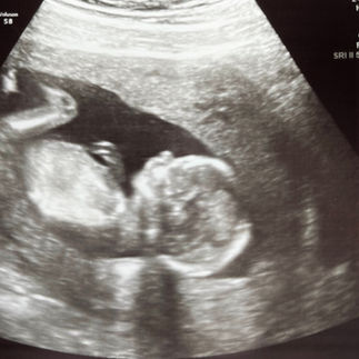 2D ultrasound during pregnancy
