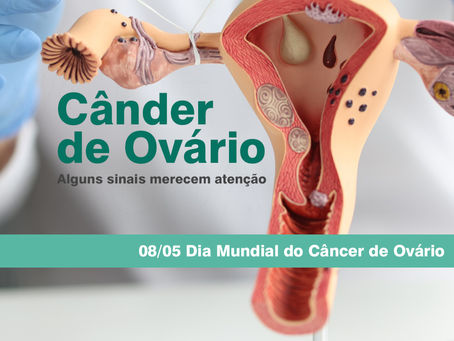 🧬 O câncer de ovário é um dos tipos de câncer ginecológico mais desafiadores, principalmente por ser silencioso em seus estágios iniciais.