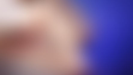 Varizes: quem faz parte do grupo de risco? O que fazer para evitar?