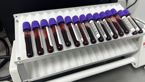 Laboratorio de la Cruz Verde Villa de Guadalupe abre con descuentos del 50 por ciento