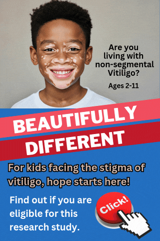 Vitiligo INCB 18424-312 BeautifullyDifferent 2-11age (320 x 480 px) 3.2.25 v3.gif
