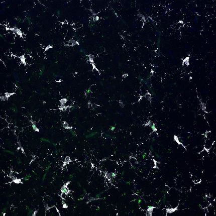 S346 m459 dapi-b vcam-g iba1-s.jpg