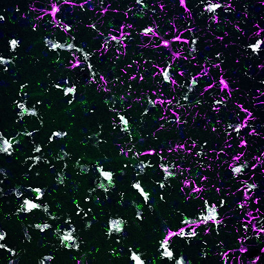 S346 m459 dapi-b vcam-g iba1-s gfap-m.jpg