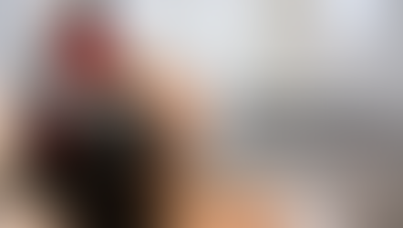 Tratamentos pós-transplante capilar: recuperação e potencialização de resultados