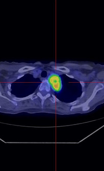 Pet lesion_edited.jpg