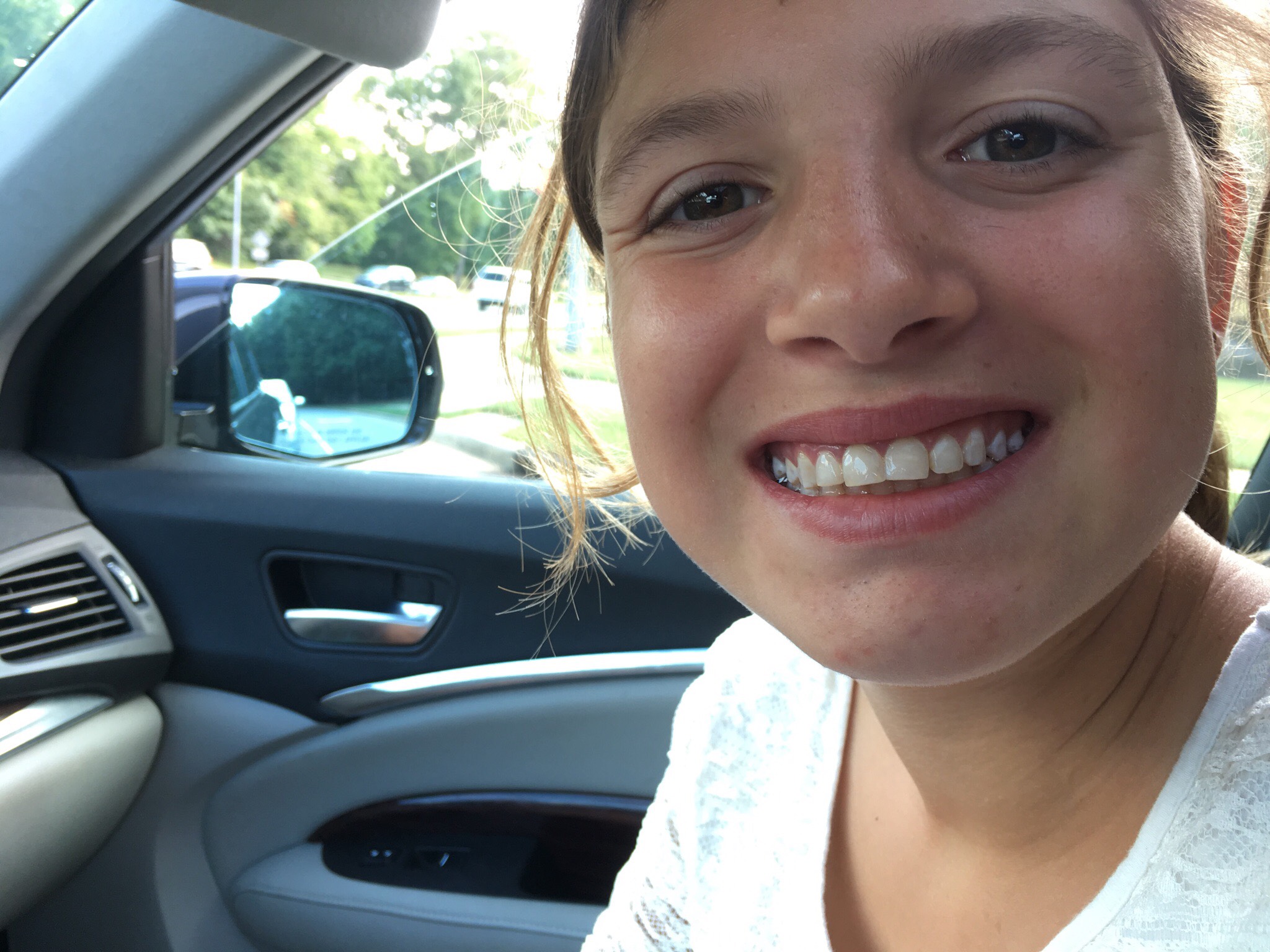 Improved Smile