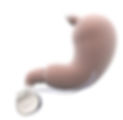 Enterra Gastric Stimulator