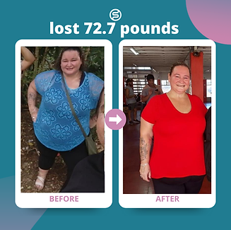Spatz Weight Loss Patient