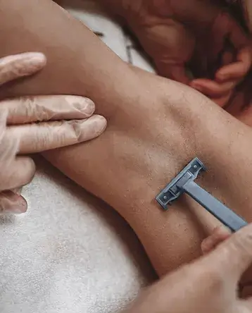 Oksels definitief ontharen - Care Clinic Apeldoorn.webp