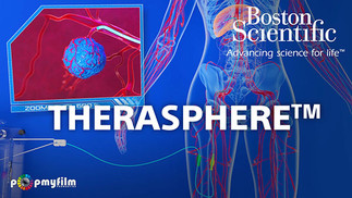 Therasphere - Boston Scientific