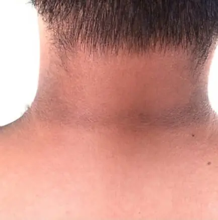 cuello-oscuro.webp