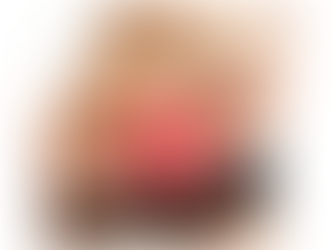 ¿Qué es la Candidiasis?