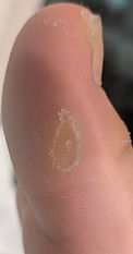 PXL_20260718_111224539.MACRO_FOCUS.jpg