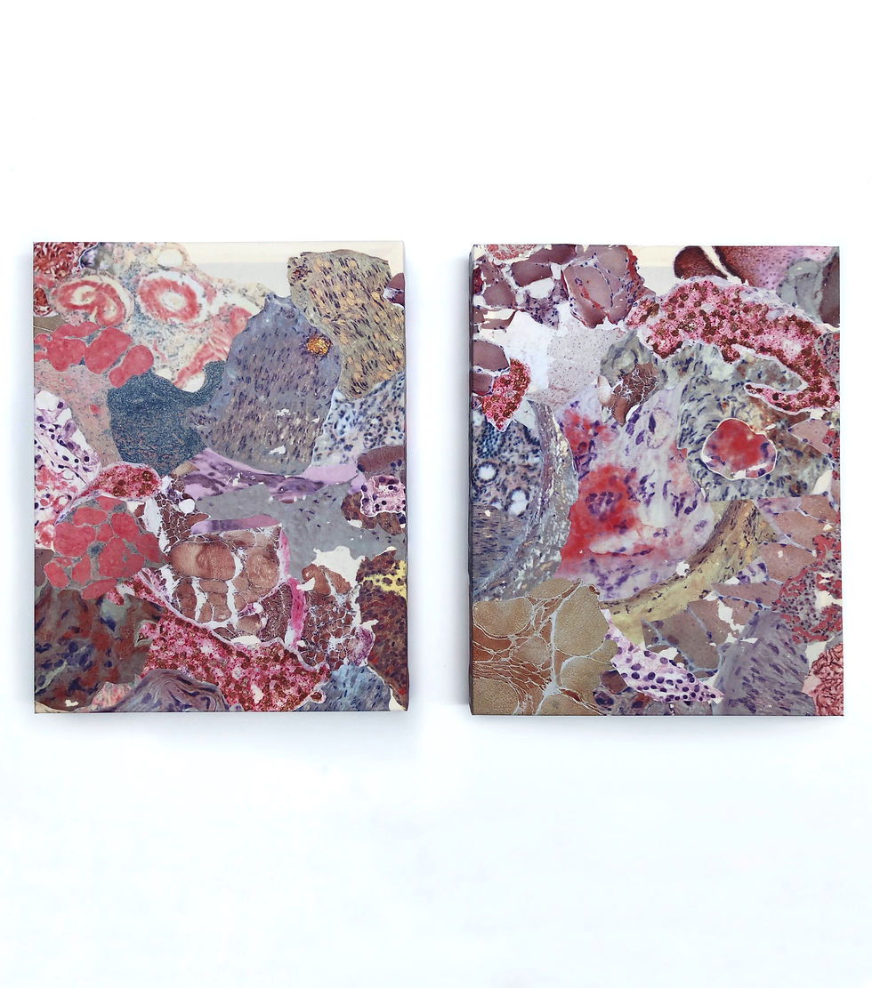 Thumbnail: Observed Tissue II