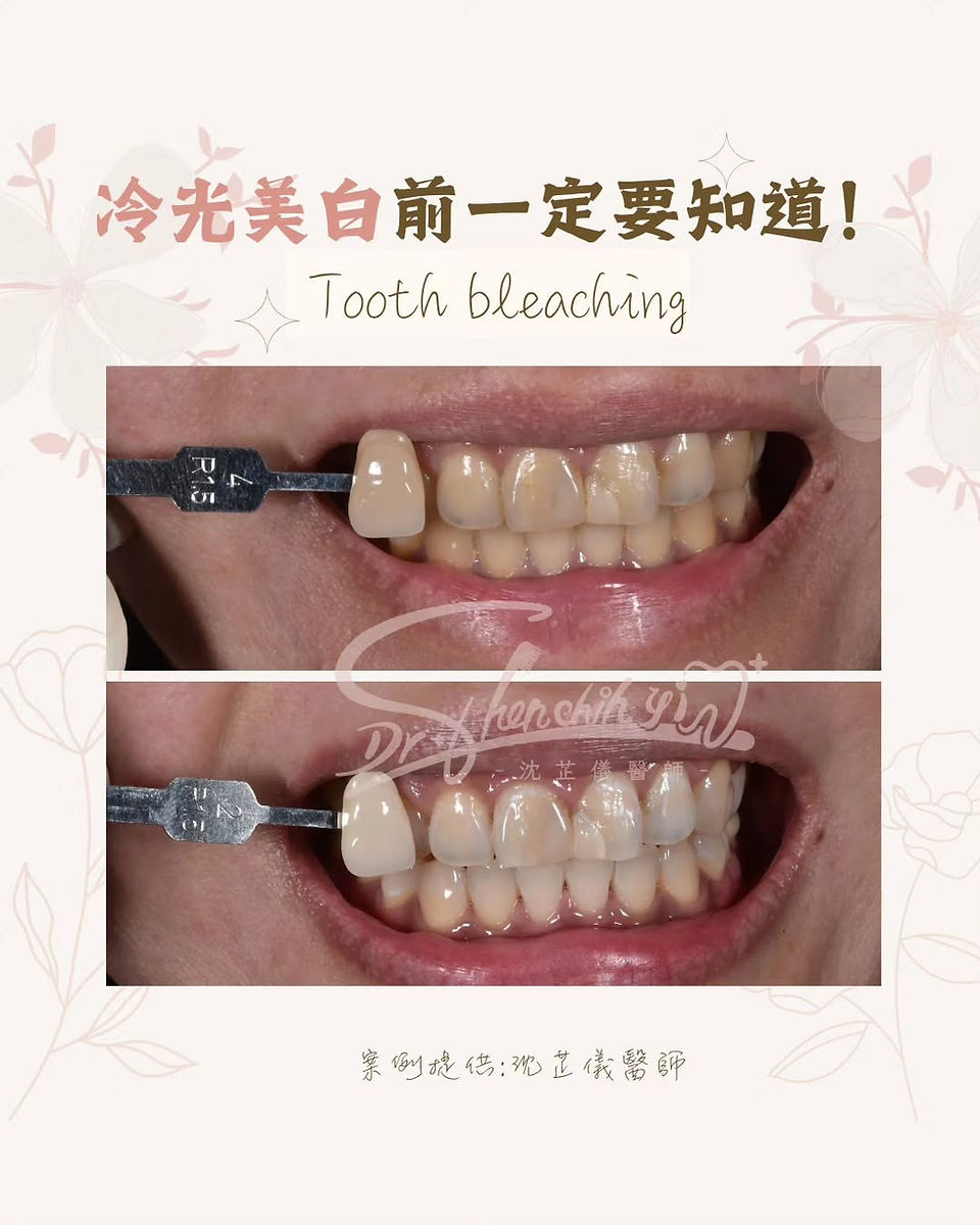 IG-004|沈芷儀醫師美白衛教貼文