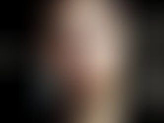 Procell Microchanneling