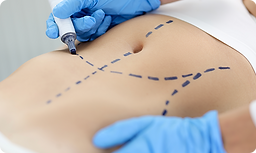 Curso Lipo HD