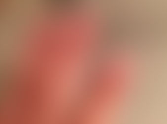 Peut‑on dire qu’un vernis gel est “non allergène” ?