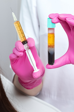 Practitioner holding vial of plasma and syringe