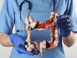 A doctor holds a plastic colon model