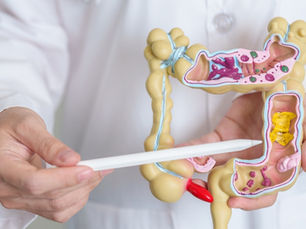 A doctor points out features on a fake large intestine.