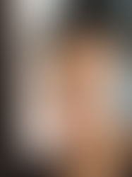 Why was it good acne happened to me?