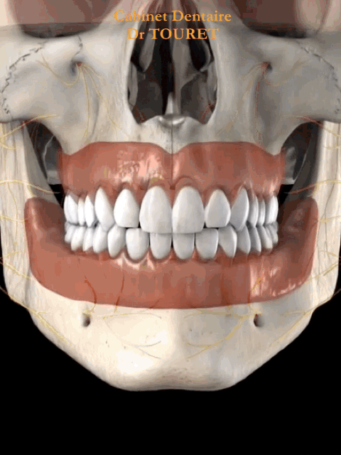 Pour aligner les dents