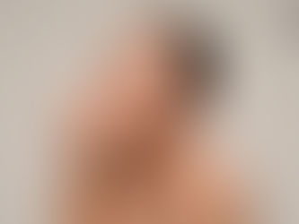 Si se preguntan para qué poner botox en la punta de la nariz la respuesta es la siguiente:  Existe un músculo llamado el depresor del tabique nasal el cual tracciona la nariz y colabora con la caída de la punta nasal. En algunos casos, relajar este músculo con botox ayuda en el proceso de rinomodelación. El músculo se origina encima de los dientes de adelante en un lugar llamado la fosa incisiva del maxilar superior y en la espina nasal anterior, y se inserta o termina en el tabique membranoso y los cartílagos laterales inferiores.
