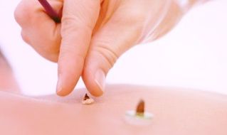 冬の季節にお灸