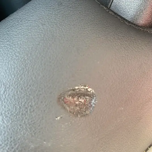 A burnt hole in the leather seat of the car.