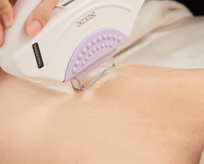 沖縄メンズ脱毛おすすめ