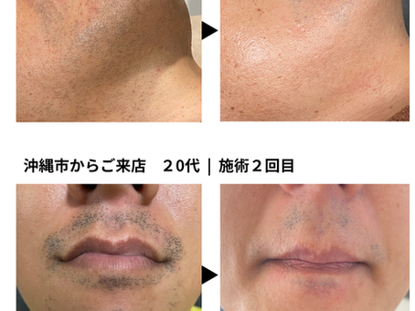 近い メンズ脱毛で変わる毎日