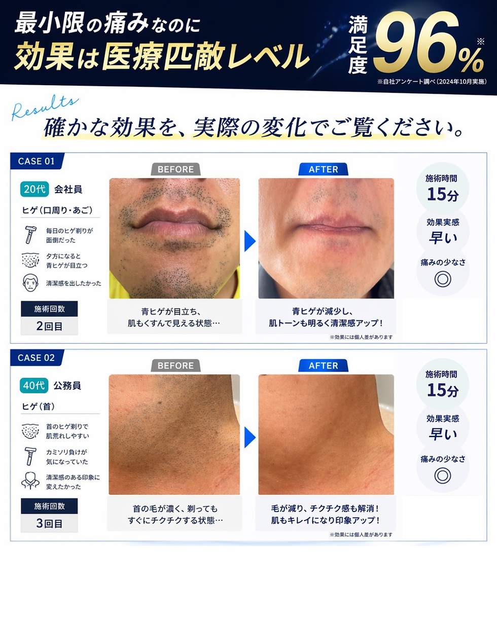 20代と40代男性のビフォーアフター写真。青ひげが改善され、肌トーンが明るく清潔感がアップ。文字は「効果は医療匹敵レベル」など。設定は広告。
