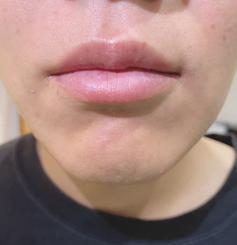 沖縄メンズ脱毛Lumos、うるま市メンズ脱毛