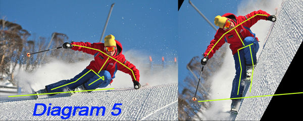 ANGULATION or INCLINATION??...What's the point?