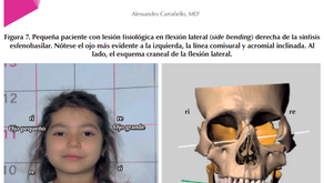 A Importancia do Análisis Postural em Pediatría