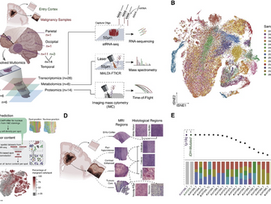 Spatially resolved multi-omics deciphers bidirectional tumor-host interdependence in glioblastoma
