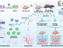 Sox2-overexpressing neural stem cells alleviate ventricular enlargement and neurological dysfunction in posthemorrhagic hydrocephalus.