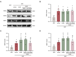 Activation of the RARα attenuated CSF hypersecretion to inhibit hydrocephalus development via regulating the MAFB/MSR1 pathway