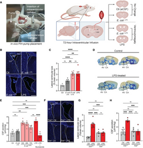The choroid plexus links innate immunity to CSF dysregulation in hydrocephalus