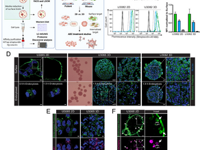 Landscape of surfaceome and endocytome in human glioma is divergent and depends on cellular spatial organization