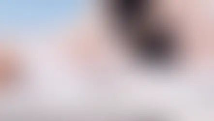 Lipœdème