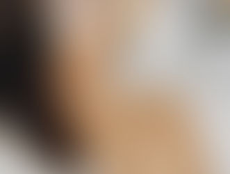 Why shave before Laser Hair Removal ?