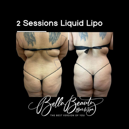 Liquid Lipo